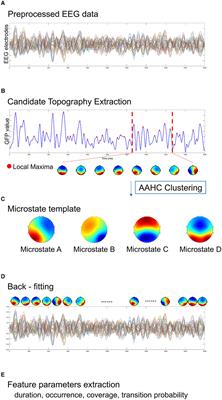 Corrigendum: EEG spectral and microstate analysis originating residual inhibition of tinnitus induced by tailor-made notched music training